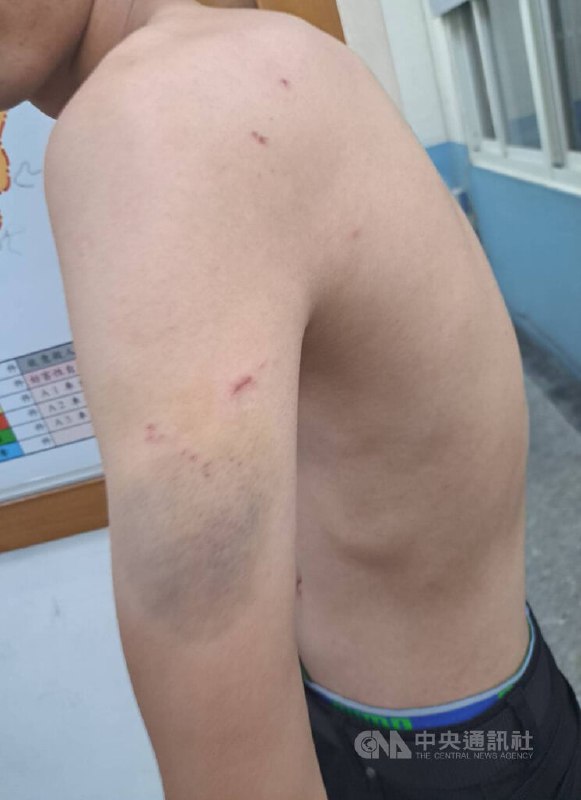 台湾，桃园市政府警察局武陵派出所3名警察涉嫌用警棍、电击棒等对一名17岁少年刑讯逼供