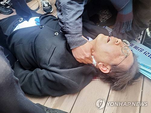 韩国最大在野党共同民主党党首李在明2日在釜山被一名身份不明的男子袭击